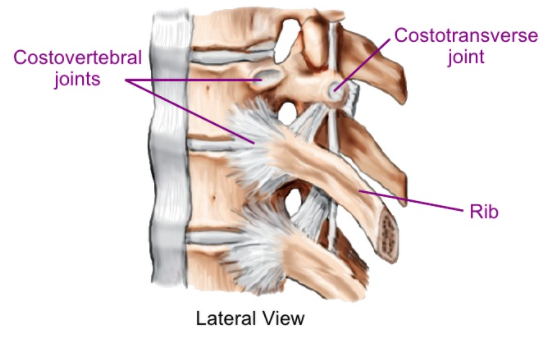 Pain in the upper back caused by muscle guarding.