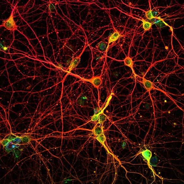 Neurons in the brain and their activity