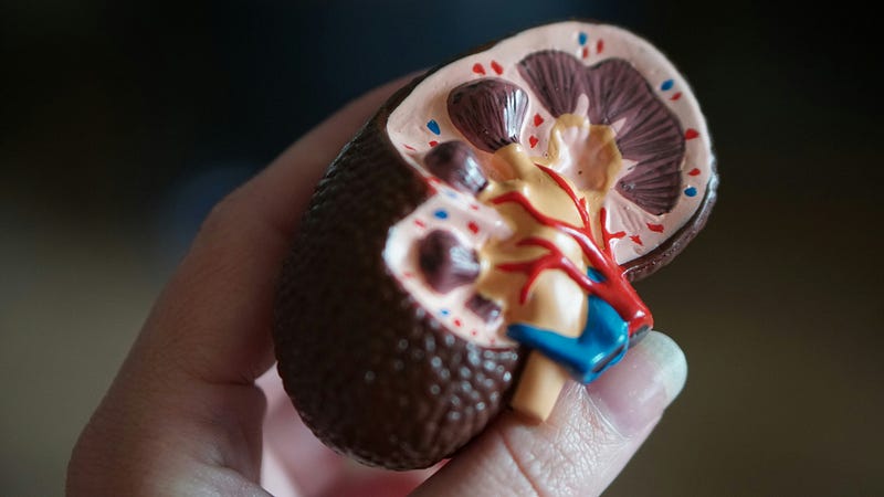 Overview of Polycystic Kidney Disease