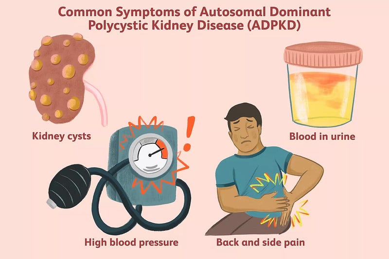 Impact of PKD on Kidney Function